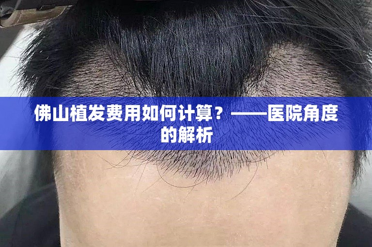 佛山植发费用如何计算？——医院角度的解析