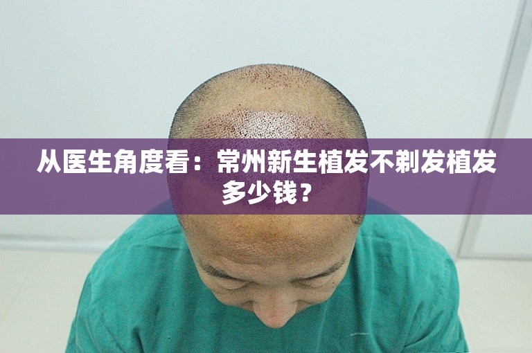 从医生角度看：常州新生植发不剃发植发多少钱？