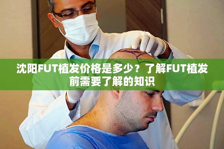 沈阳FUT植发价格是多少？了解FUT植发前需要了解的知识