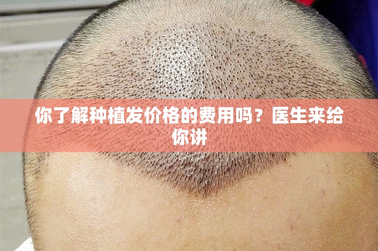 你了解种植发价格的费用吗？医生来给你讲