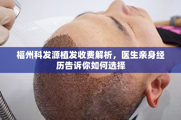 福州科发源植发收费解析，医生亲身经历告诉你如何选择