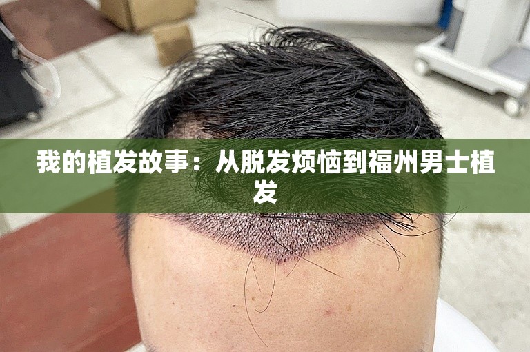 我的植发故事：从脱发烦恼到福州男士植发