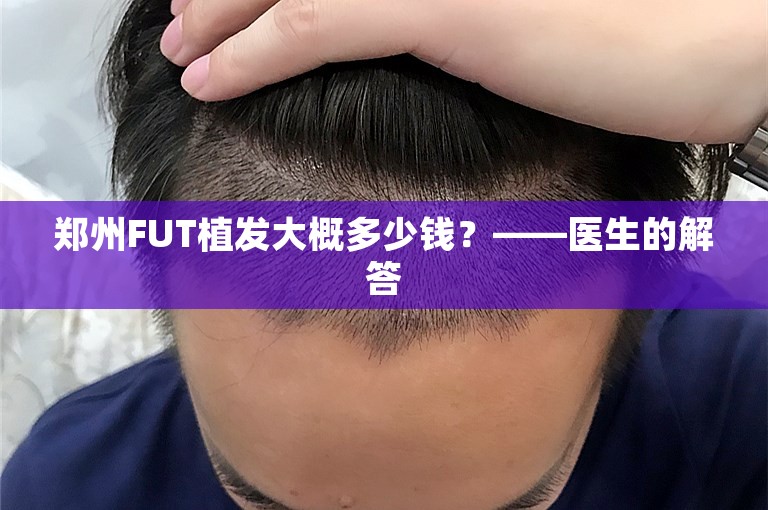 郑州FUT植发大概多少钱？——医生的解答