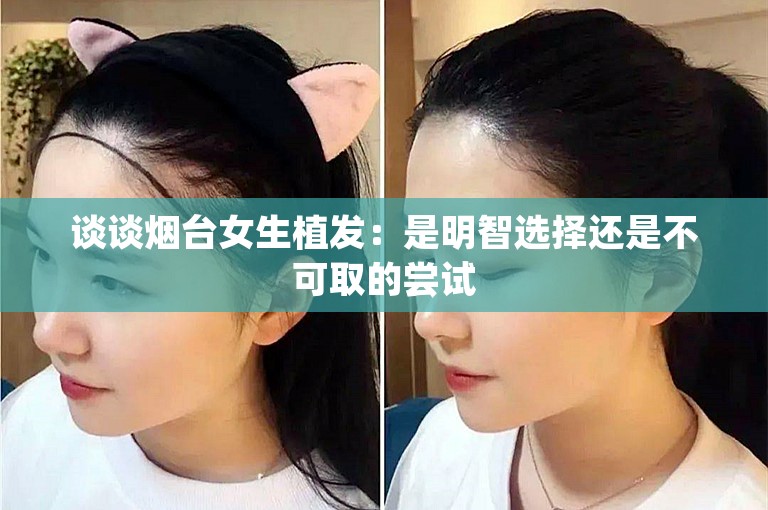 谈谈烟台女生植发：是明智选择还是不可取的尝试