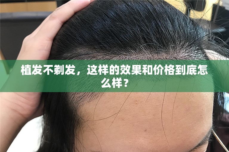 植发不剃发，这样的效果和价格到底怎么样？