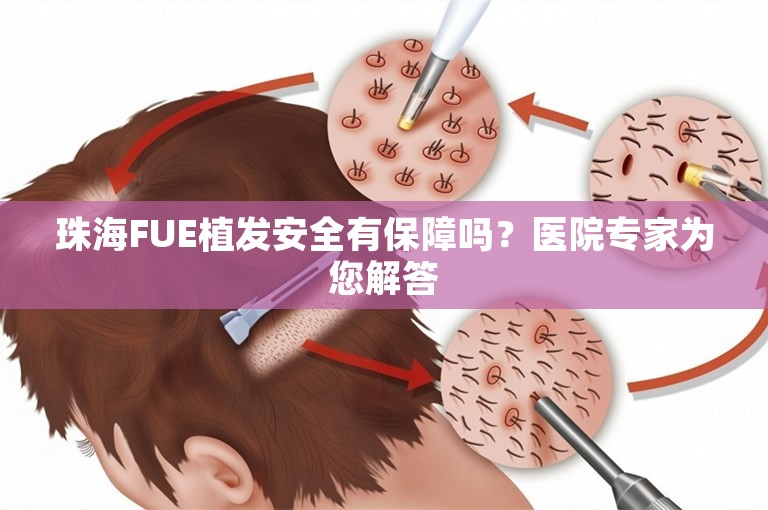 珠海FUE植发安全有保障吗？医院专家为您解答