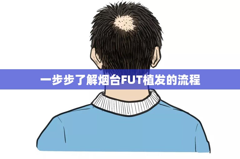 一步步了解烟台FUT植发的流程