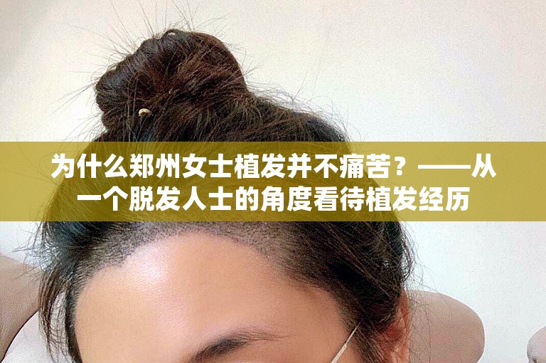 为什么郑州女士植发并不痛苦？——从一个脱发人士的角度看待植发经历