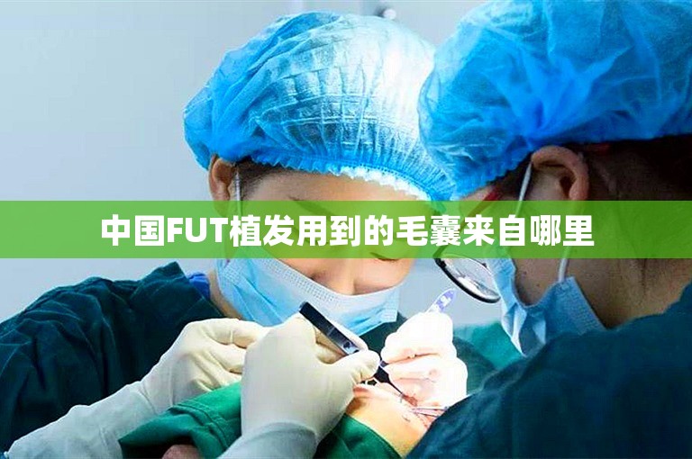 中国FUT植发用到的毛囊来自哪里