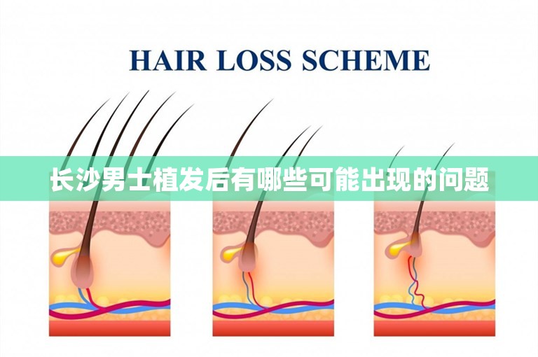 长沙男士植发后有哪些可能出现的问题