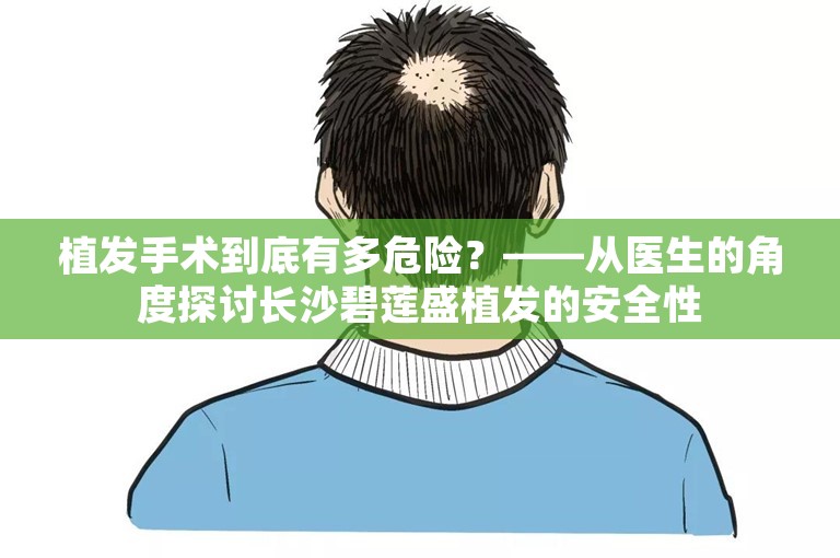 植发手术到底有多危险？——从医生的角度探讨长沙碧莲盛植发的安全性