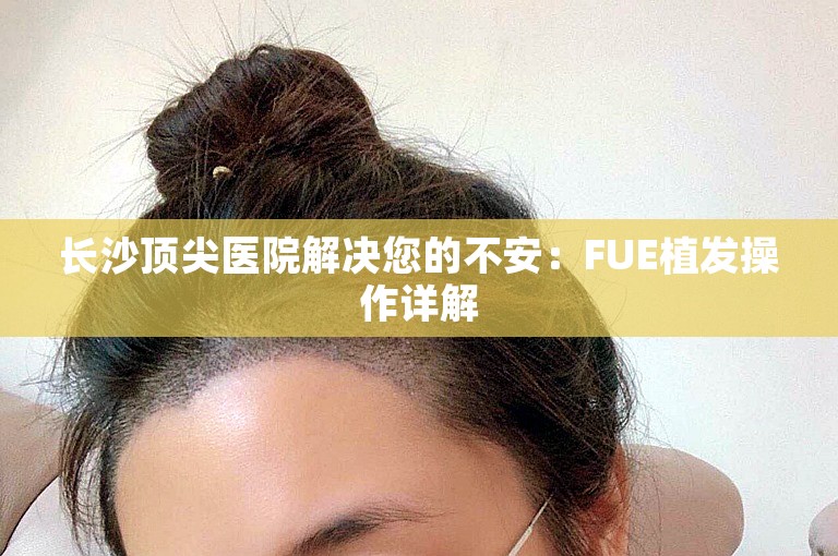 长沙顶尖医院解决您的不安：FUE植发操作详解