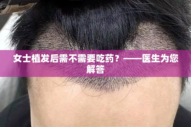 女士植发后需不需要吃药？——医生为您解答