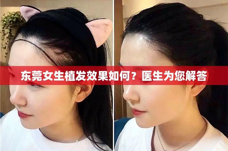 东莞女生植发效果如何？医生为您解答