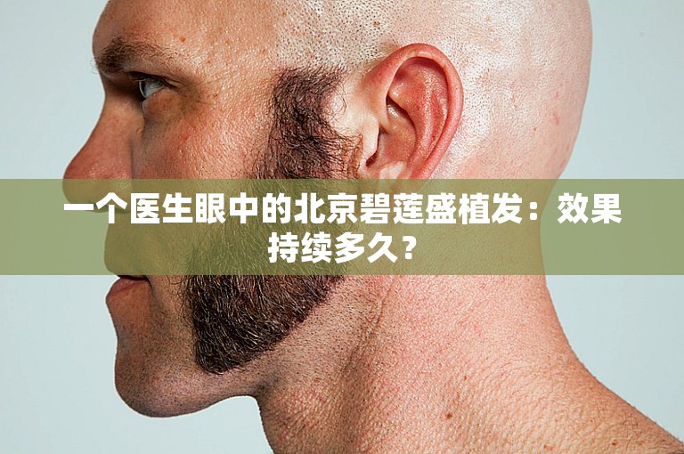 一个医生眼中的北京碧莲盛植发：效果持续多久？