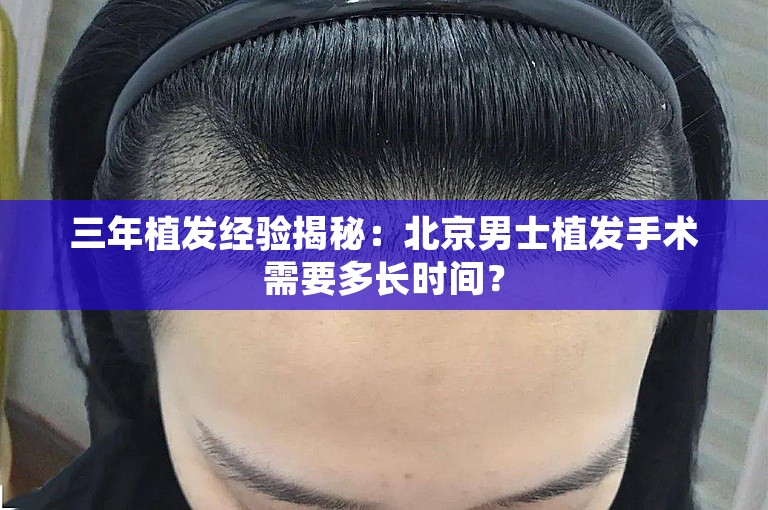 三年植发经验揭秘：北京男士植发手术需要多长时间？