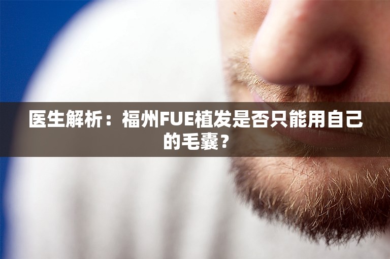 医生解析：福州FUE植发是否只能用自己的毛囊？