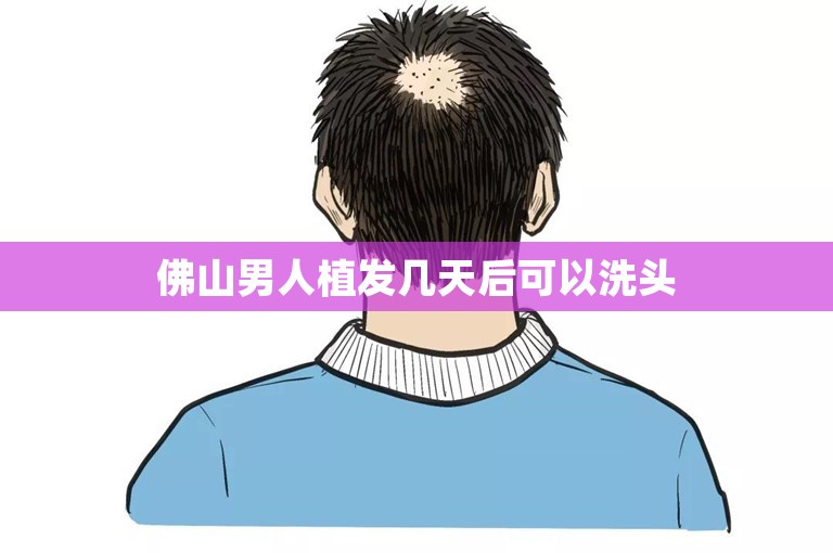 佛山男人植发几天后可以洗头