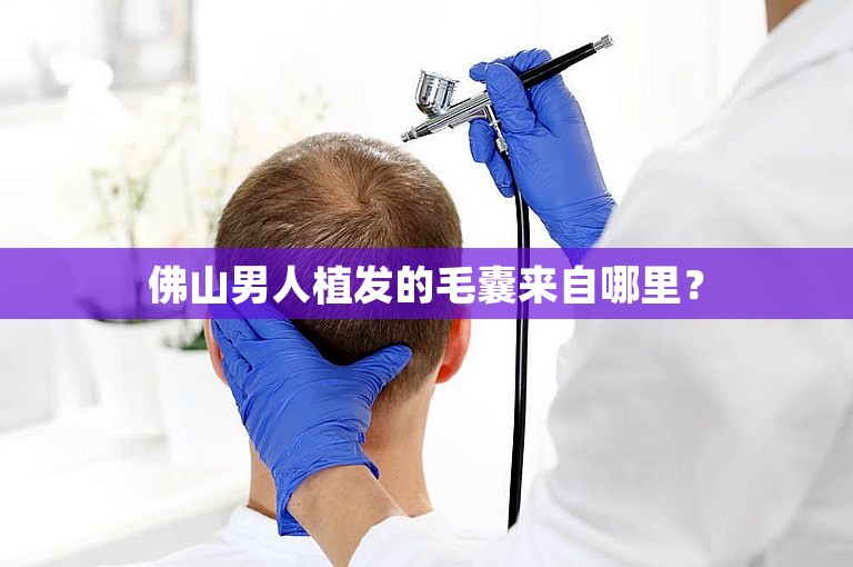 佛山男人植发的毛囊来自哪里？