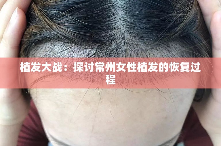 植发大战：探讨常州女性植发的恢复过程