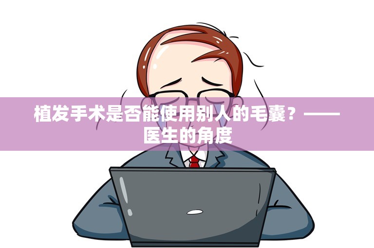 植发手术是否能使用别人的毛囊？——医生的角度