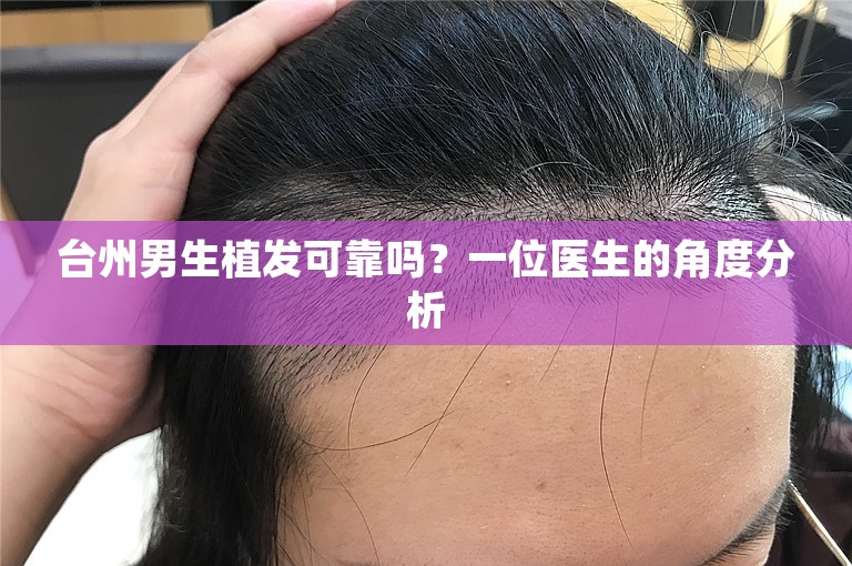 台州男生植发可靠吗？一位医生的角度分析