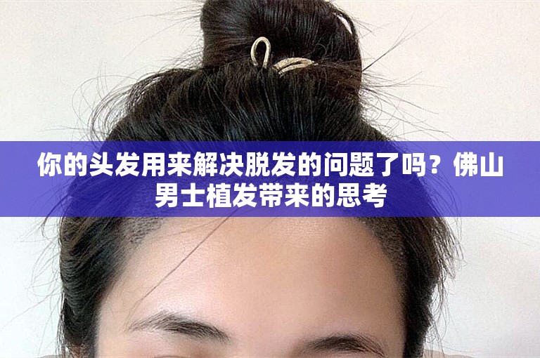 你的头发用来解决脱发的问题了吗？佛山男士植发带来的思考