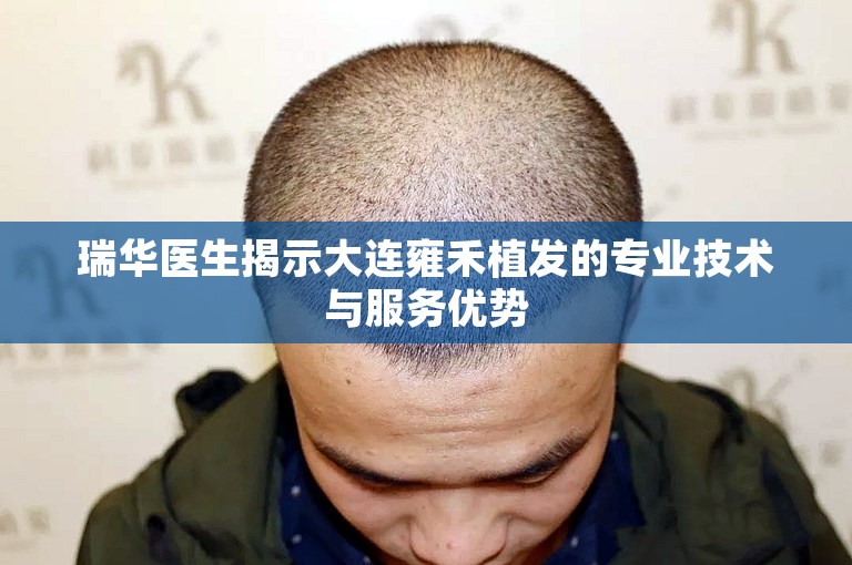 瑞华医生揭示大连雍禾植发的专业技术与服务优势