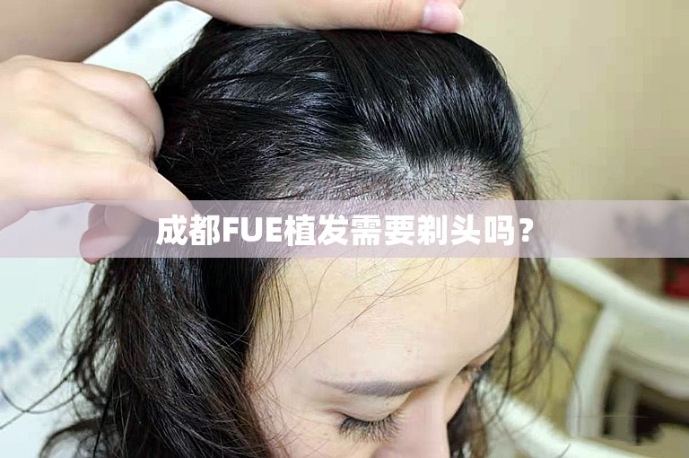 成都FUE植发需要剃头吗？