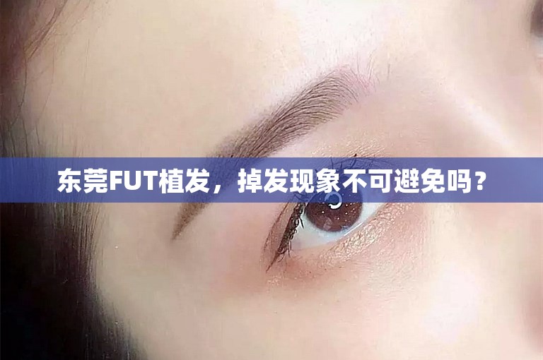 东莞FUT植发，掉发现象不可避免吗？