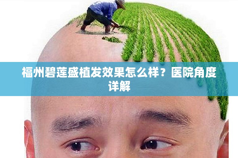 福州碧莲盛植发效果怎么样？医院角度详解