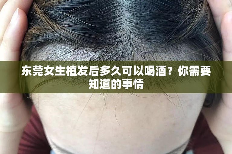 东莞女生植发后多久可以喝酒？你需要知道的事情