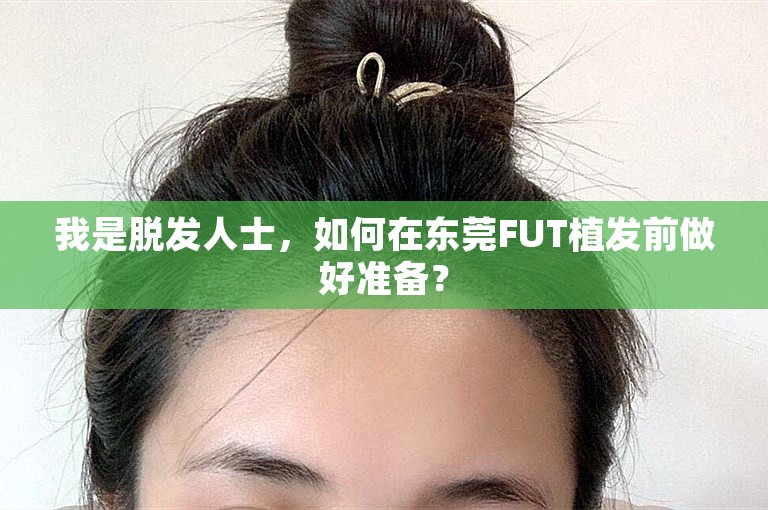 我是脱发人士，如何在东莞FUT植发前做好准备？