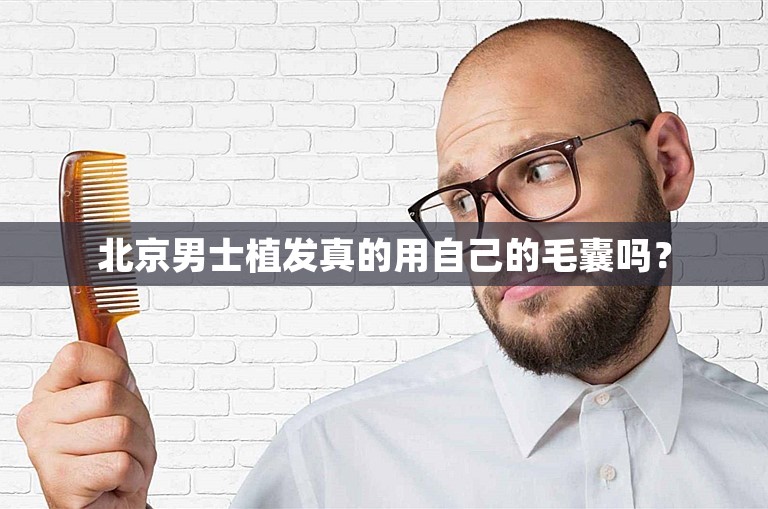 北京男士植发真的用自己的毛囊吗？