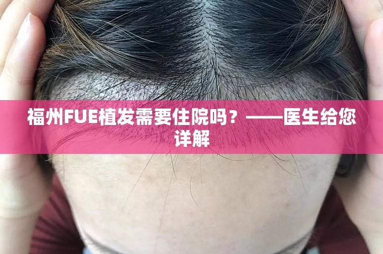 福州FUE植发需要住院吗？——医生给您详解