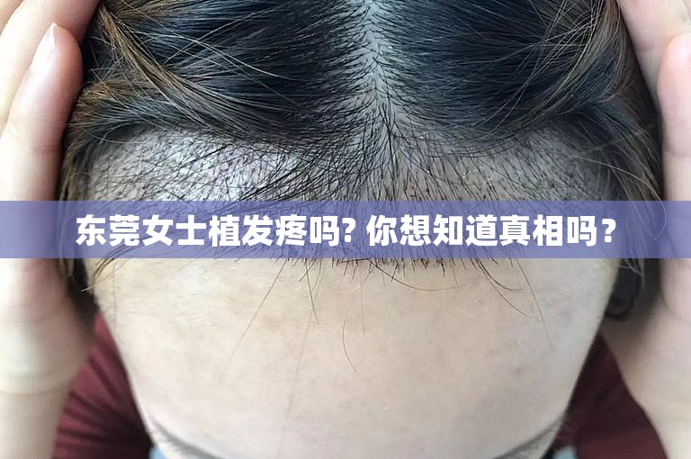 东莞女士植发疼吗? 你想知道真相吗？