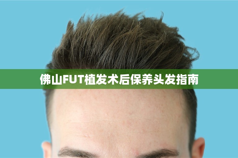 佛山FUT植发术后保养头发指南