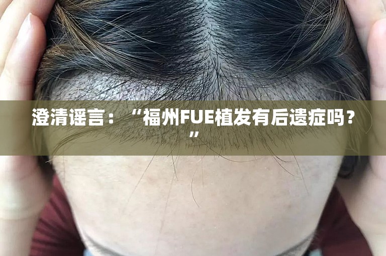 澄清谣言：“福州FUE植发有后遗症吗？”