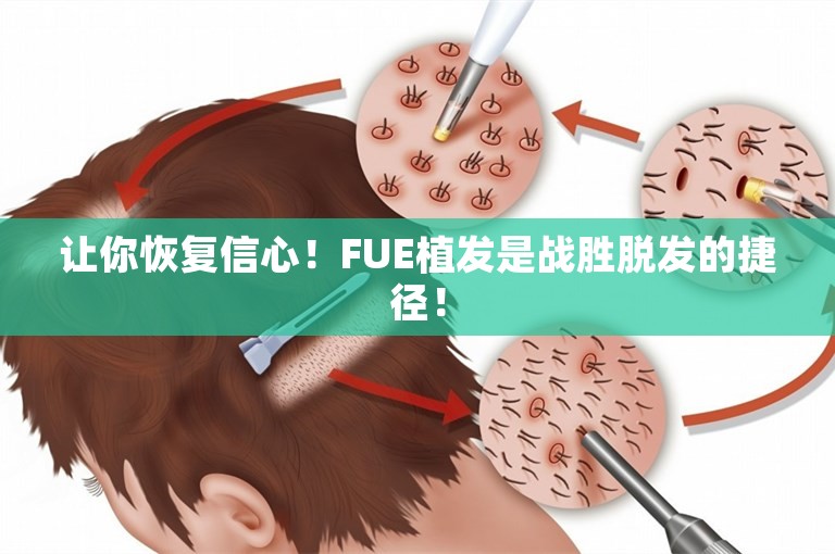 让你恢复信心！FUE植发是战胜脱发的捷径！