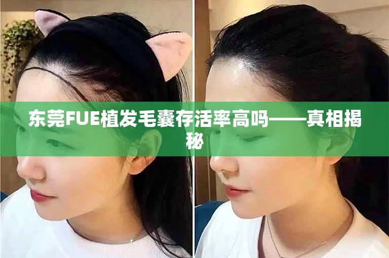 东莞FUE植发毛囊存活率高吗——真相揭秘