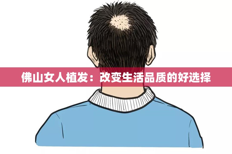 佛山女人植发：改变生活品质的好选择