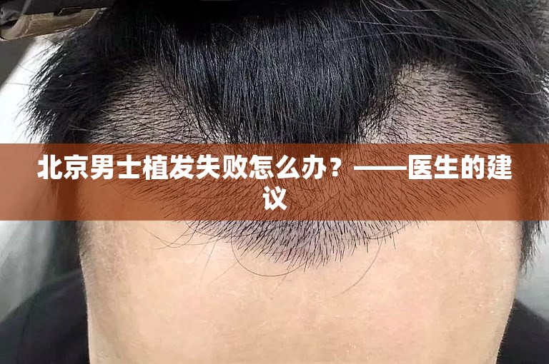 北京男士植发失败怎么办？——医生的建议