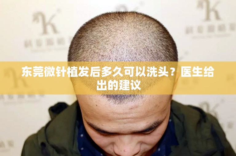 东莞微针植发后多久可以洗头？医生给出的建议