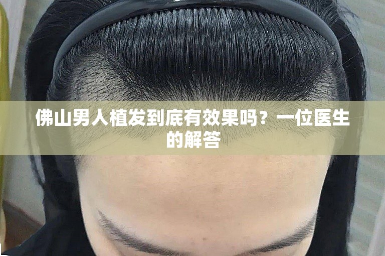 佛山男人植发到底有效果吗？一位医生的解答