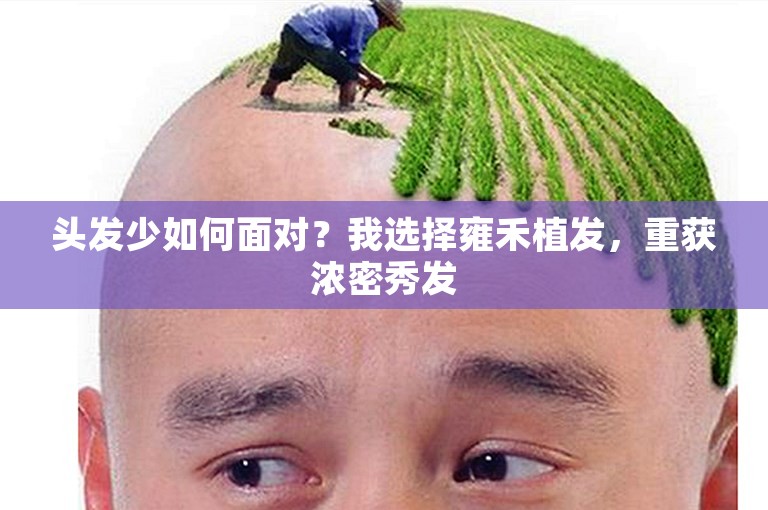 头发少如何面对？我选择雍禾植发，重获浓密秀发