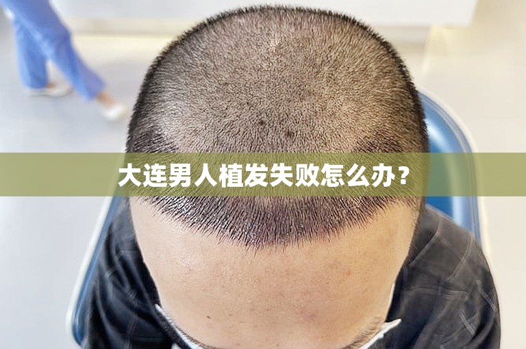 大连男人植发失败怎么办？