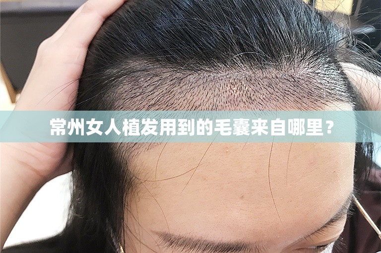 常州女人植发用到的毛囊来自哪里？