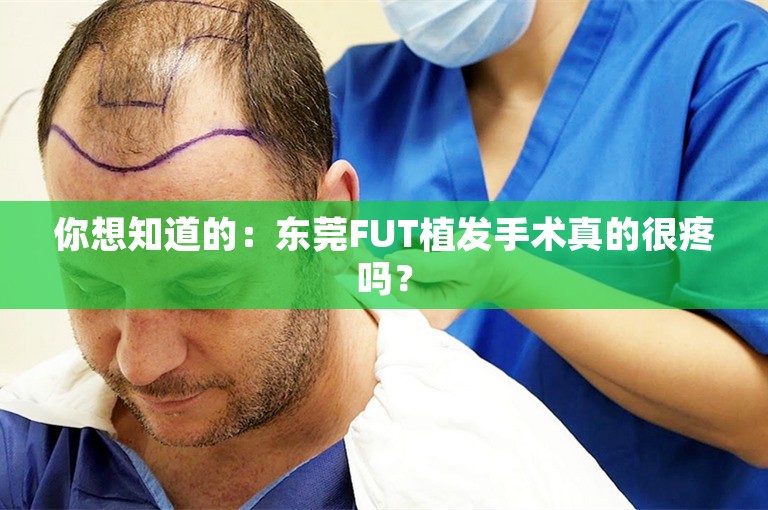 你想知道的：东莞FUT植发手术真的很疼吗？